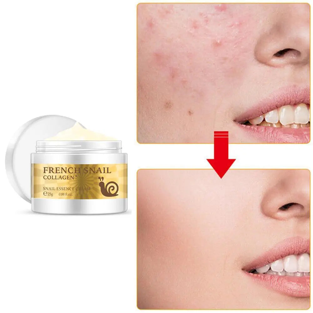 Snail Rejuvenating Face Cream Hyaluronic Acid Moisturizer Anti Aging Collagen Skin Care Health Nourishing Serum